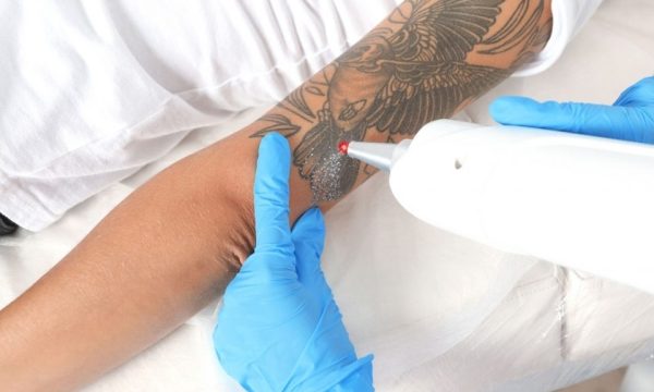 Do Tattoos Hurt And Are They Worth It?