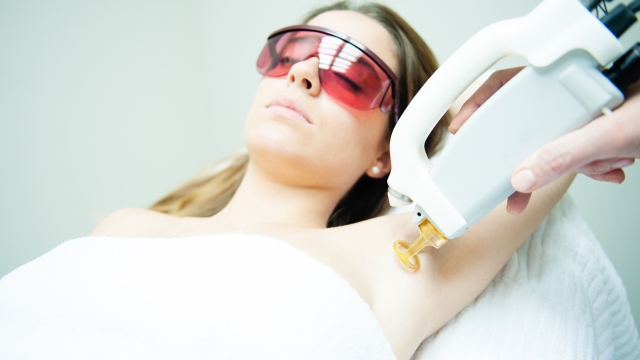 Silky Smooth: The Ultimate Guide to Laser Hair Removal